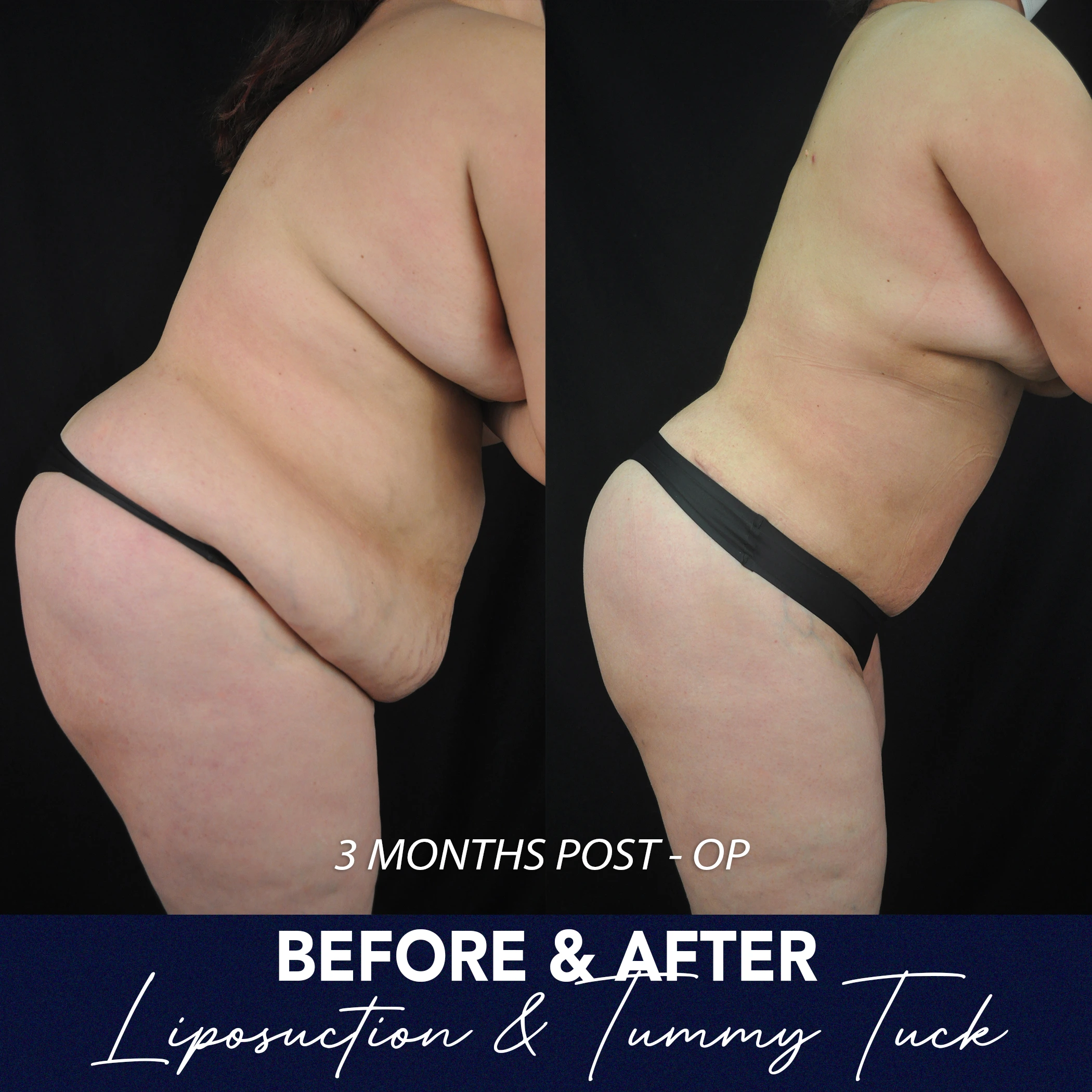 KAREN B&A