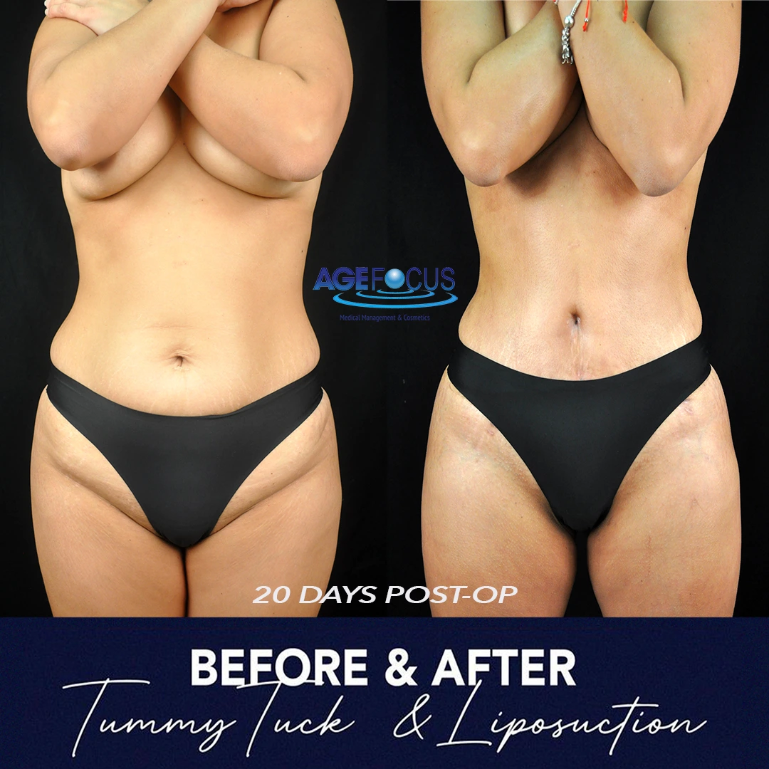LIPO MARTA R