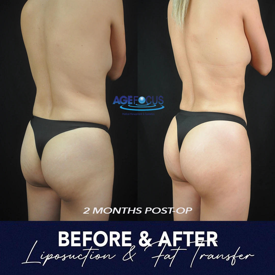 helen p b&a butt