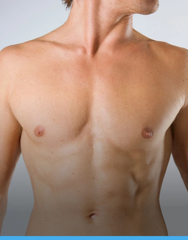 Long Island, NY Awake Gynecomastia Surgery: Benefits of Awake Gynecomastia Surgery Banner