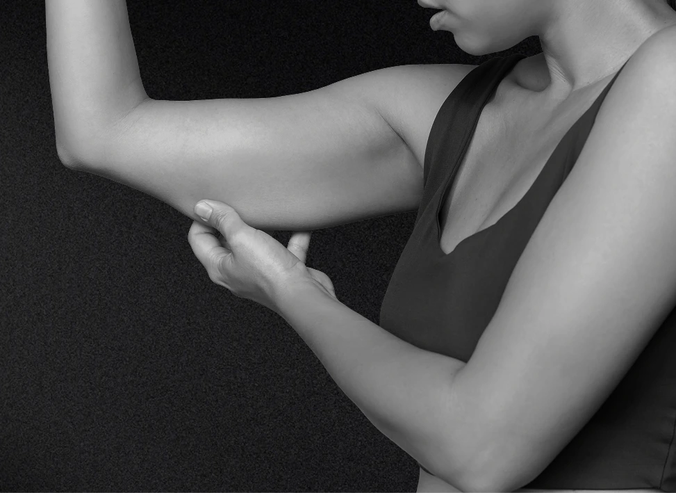 Awake Arm Lift in Long Island, NY Banner